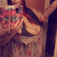559-400-2182