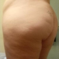 904-780-7141