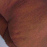662-340-8178