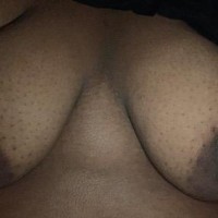 410-518-5441