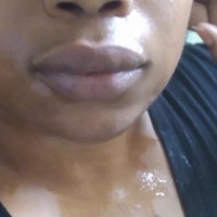 Lips