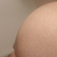 862-255-6424