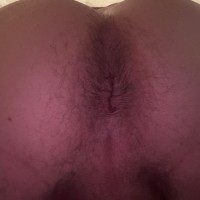 314-904-2551