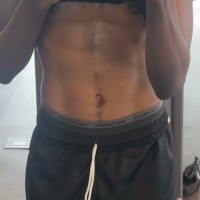 415-737-4515