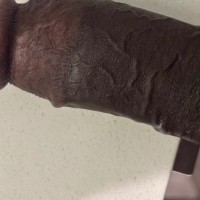 704-318-4931